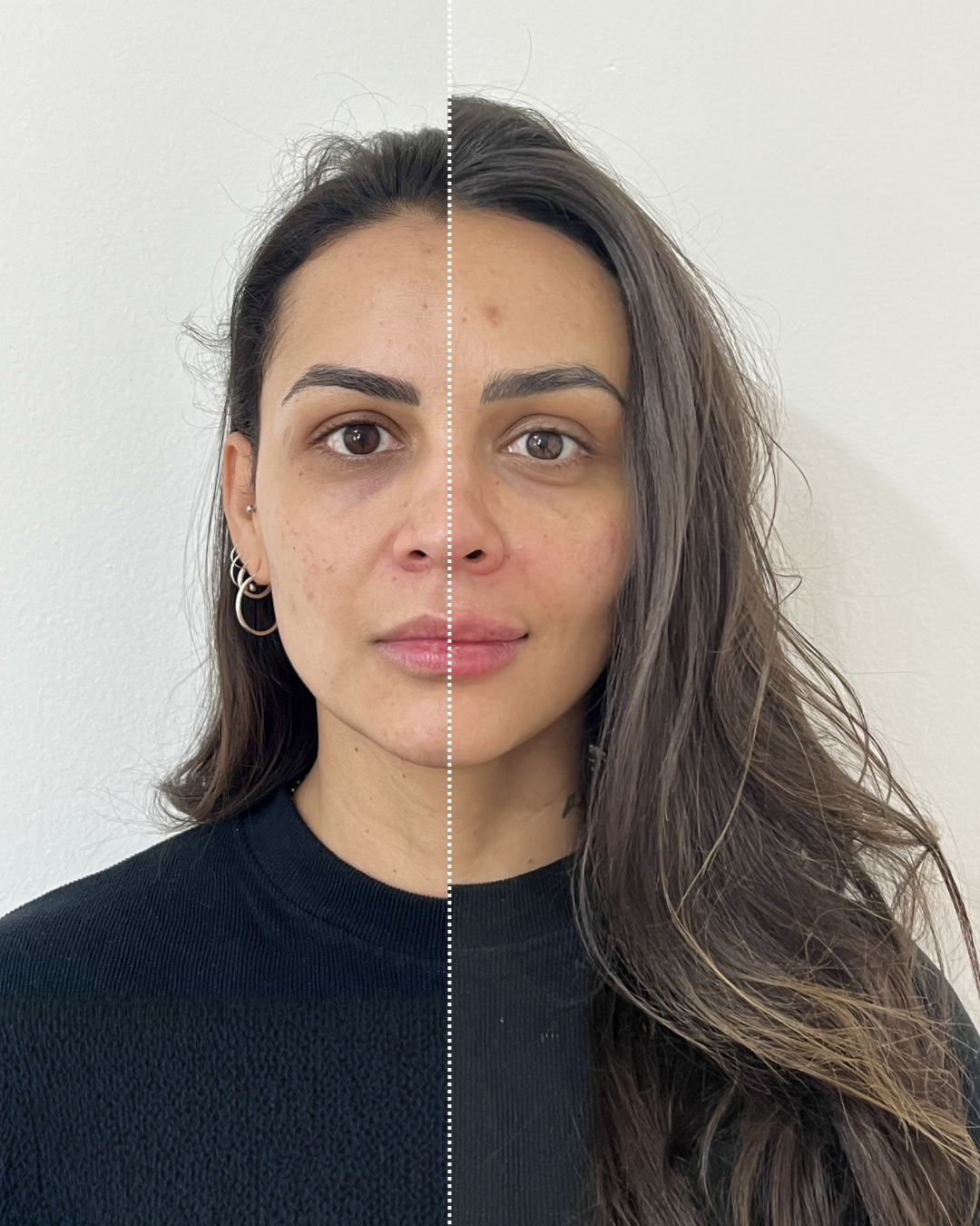 Antes e Depois — Dra. Amanda Fernandes