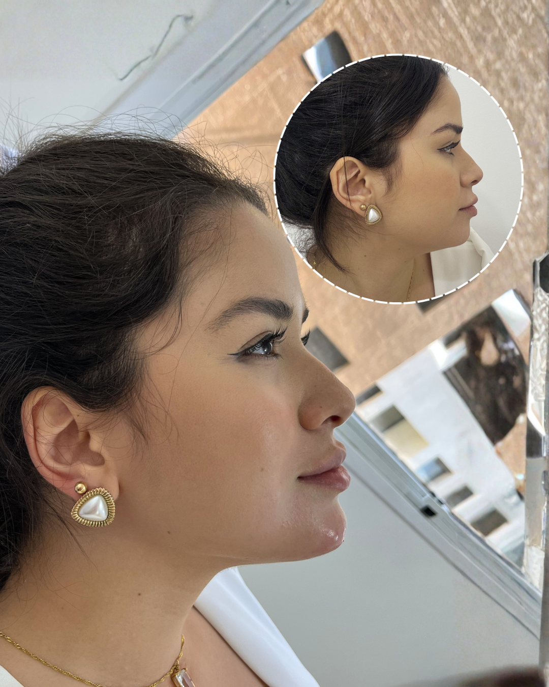 Antes e Depois — Dra. Amanda Fernandes