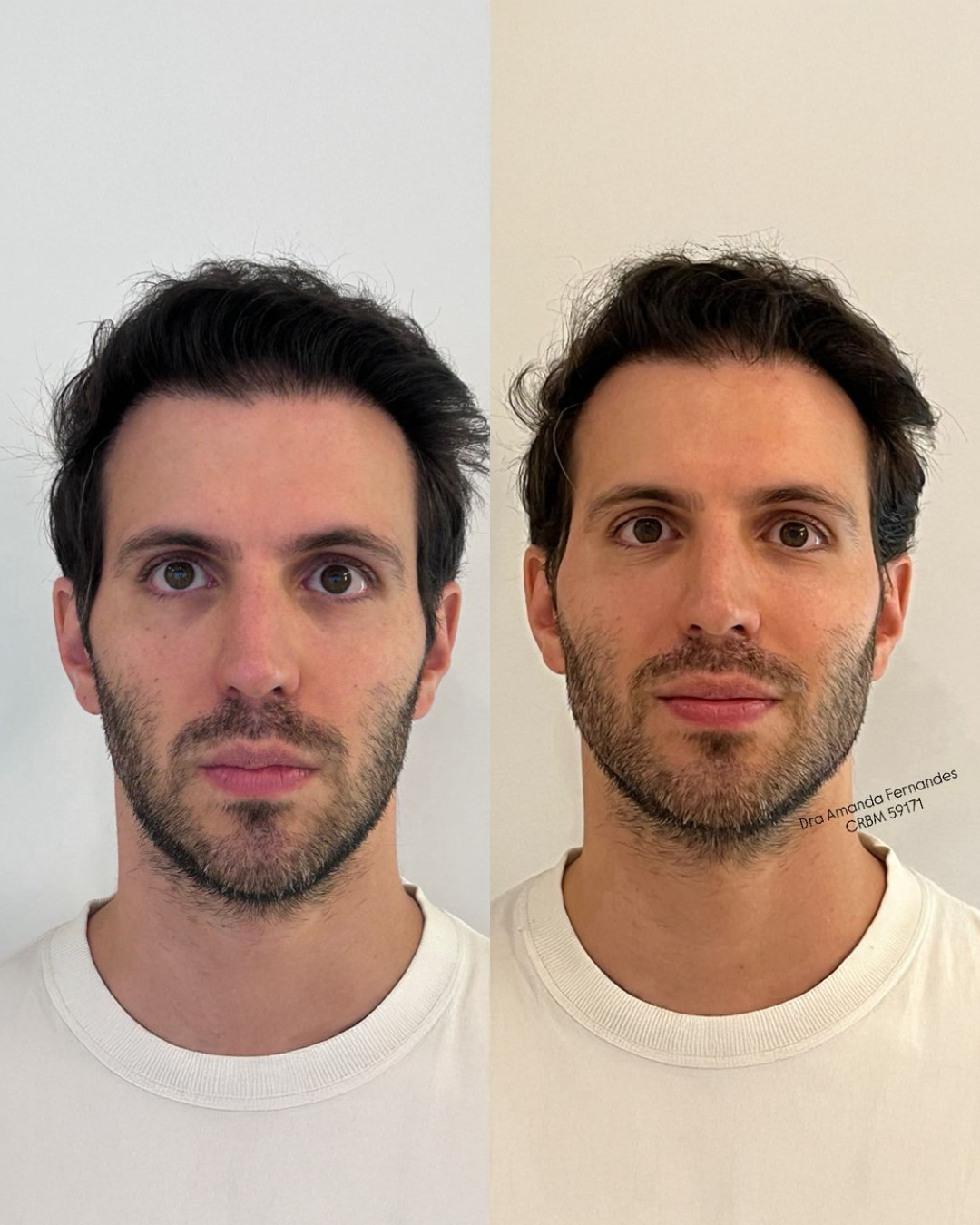 Antes e Depois — Dra. Amanda Fernandes